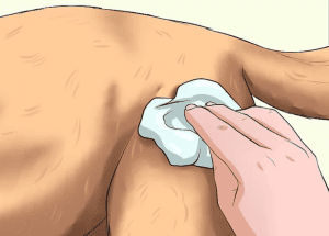 pulire ferita - tamponare
