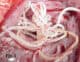 filaria cardiopolmonare