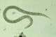 Anchilostoma, tenia, ascaridi