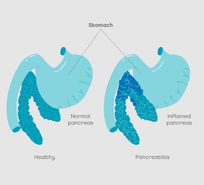 disturbo e cause della pancreatite nel cane