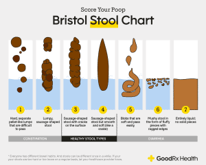tipologia di feci nel canel secono il Bristol_Stool_Chart